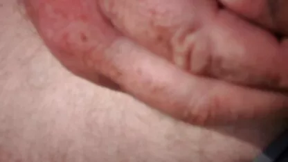 Un aloha porno free garçon pour deux filles et la boulimie